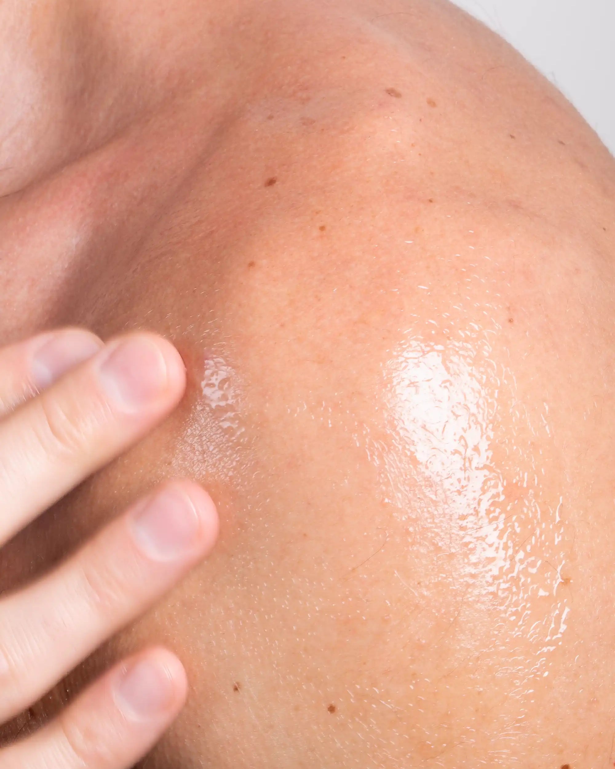 Blemicalm Body Skin Clearing Spray